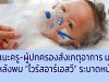 แนะครู-ผู้ปกครองสังเกตุอาการ นร.หลังพบ “ไวรัสอาร์เอสวี” ระบาดหนัก